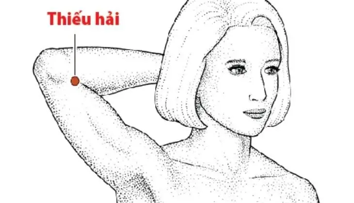Huyệt Thiếu Hải